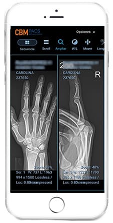 Pantalla grande con grilla del PACS