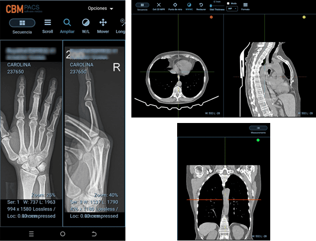 Visualizador HTML5 y 2D MPR