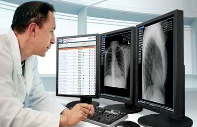 Pantalla grande con grilla del PACS